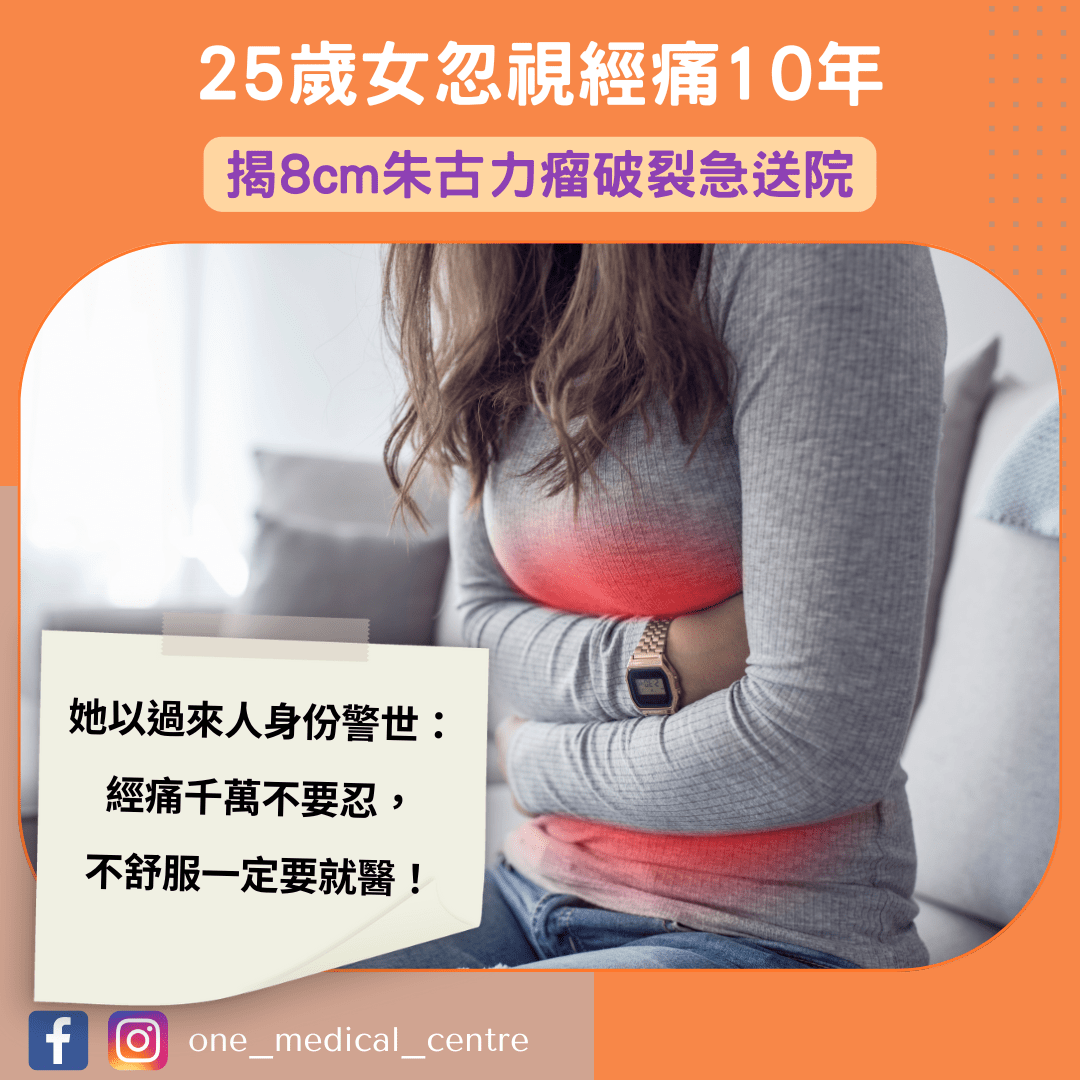 【25歲女忽視經痛10年　揭8cm朱古力瘤破裂急送院】